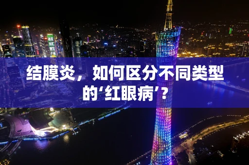 结膜炎，如何区分不同类型的‘红眼病’？
